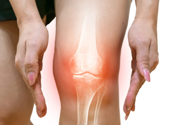 knee pain