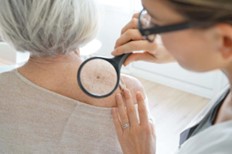 Priority Skin Cancer Screening Appointments Available