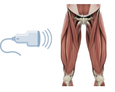 Musculoskeletal Ultrasound