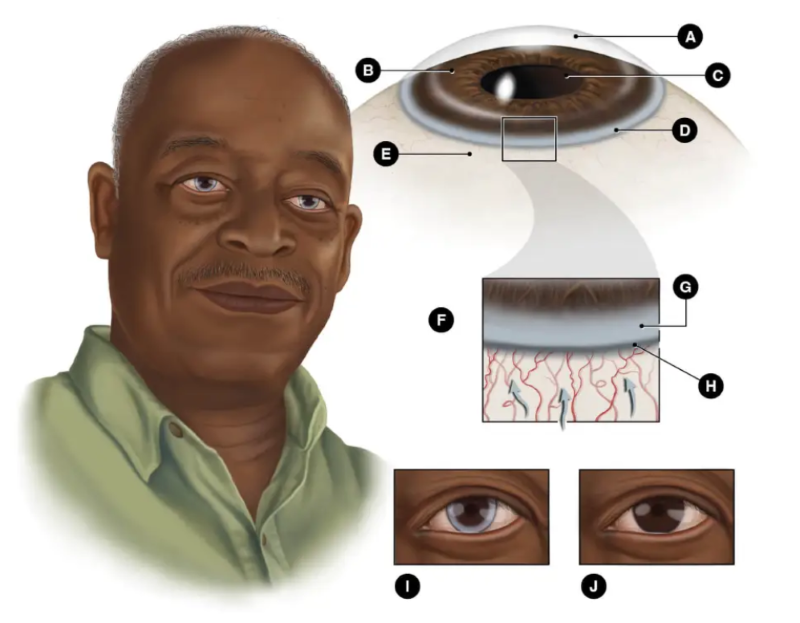 sample illustration of eye illustration from Illustrate Change