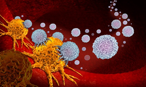 Cancer with immune cells
