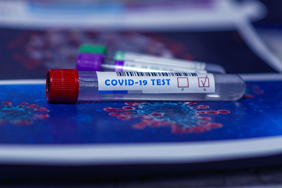 COVID-19 test vial placed on top of image of coronavirus as viewed from a microscope.