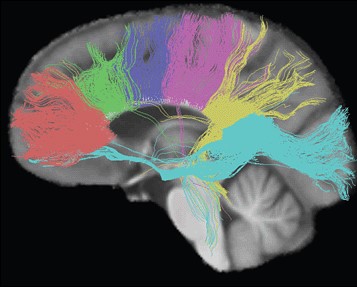 colorful photo of brain