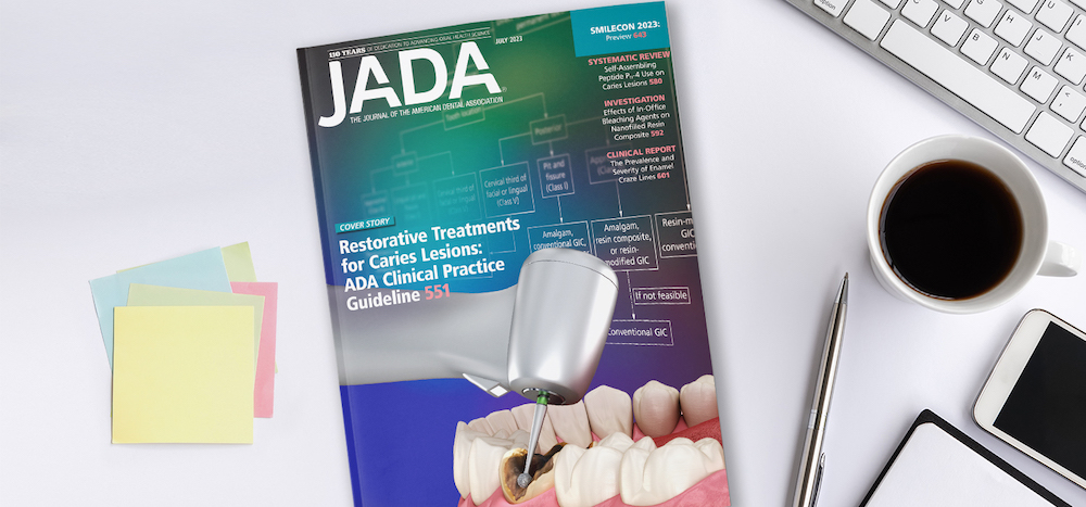American Dental Association Releases New Clinical Practice Guidelines on Caries Restorations